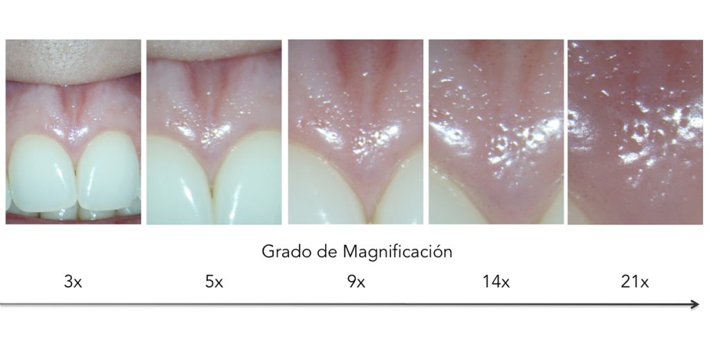 endodoncia quirúrgica zaragoza