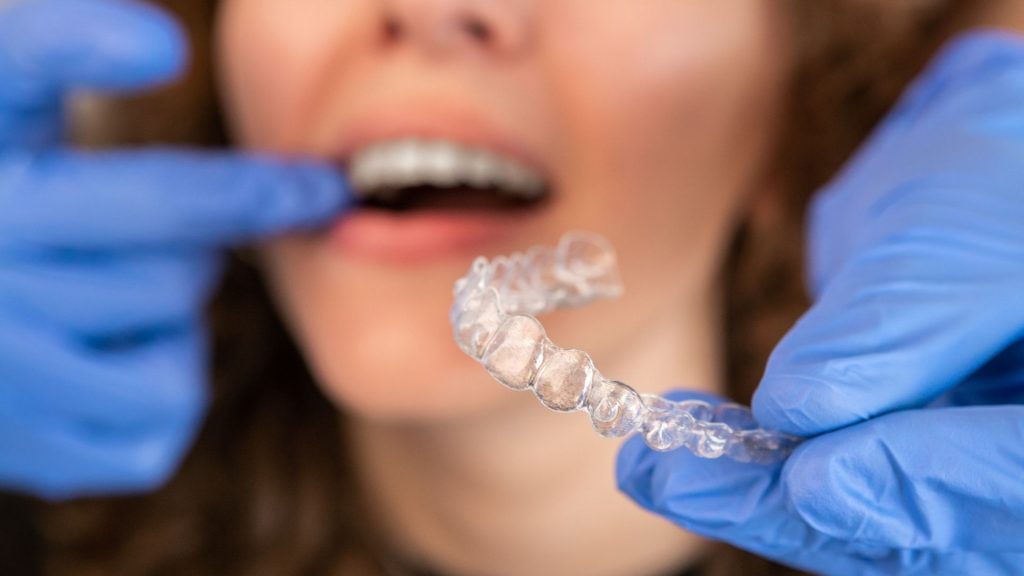 invisalign Clinica dental zoe 